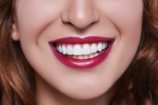veneers-dominican-republic:-the-best-place-for-veneers-in-dominican-republic-at-ced-dental-center